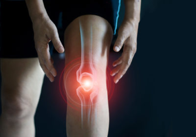 Elderly,Woman,Suffering,From,Pain,In,Knee.,Tendon,Problems,And